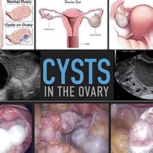 Ovarian Cyst Clinic Singapores Profile Muck Rack