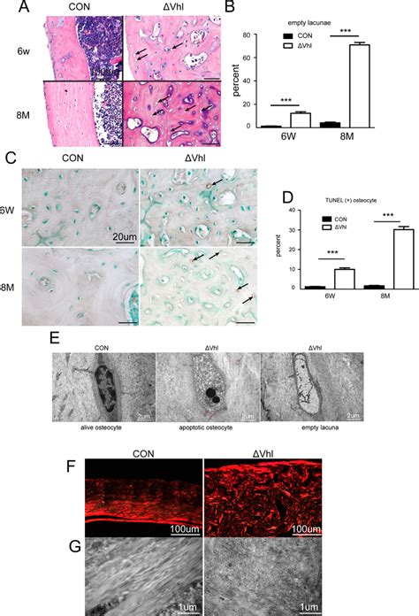 Deletion Of Vhl In Osteocytes And Mature Osteoblasts Results In