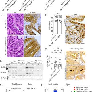 Loss Of Mpc1 Accelerates Tumor Initiation And Dysplastic Progression In