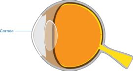 cornea helix eye care