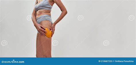 Mature Lady Showing Orange Peel On Her Leg Stock Image Image Of