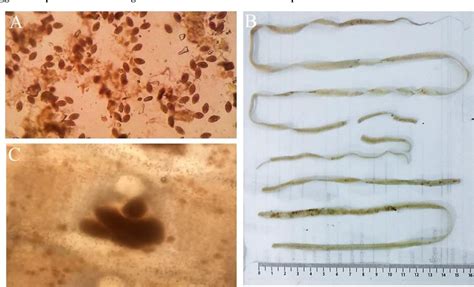 Figure From Spirometra Mansonoides From A Domestic Cat In