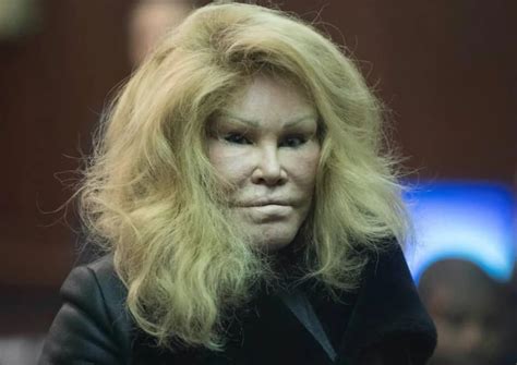 Socialite Jocelyn Wildenstein Catwoman Is Living On A Month