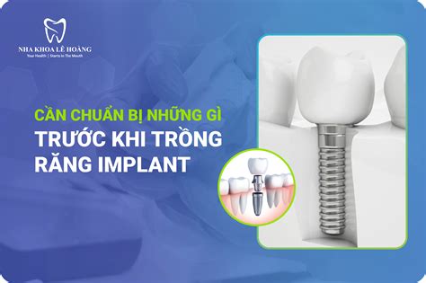 Các Lưu Ý Sau Khi Cấy Ghép Implant Nha Khoa Lê Hoàng