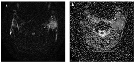 Cancers Free Full Text The Value Of Multiparametric Magnetic