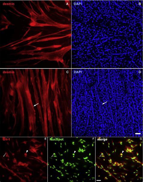 Shh Induces Cell Proliferation And Gli 1 Nuclear Localization In