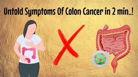 Colon Cancer Symptoms Prevention Cure Which Requires Urgent