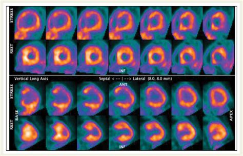 Figure 1 From Role Of Multimodality Cardiac Imaging In The Management