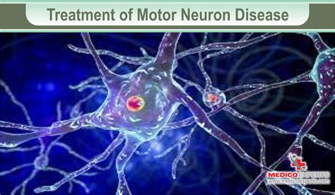 Motor Neuron Disease Treatment in India: Current Options