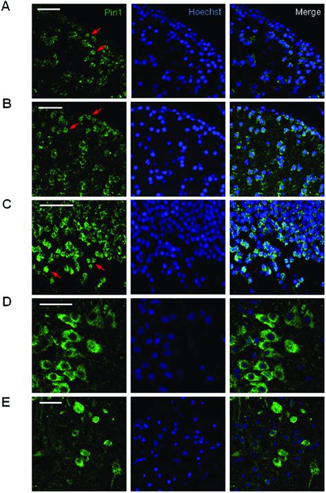 Pin Subcellular Localization In The Adult Zebrafish Brain Confocal