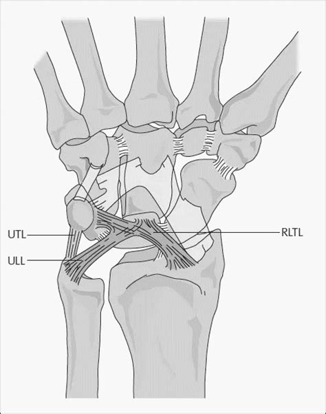 Wrist Ligaments Epomedicine