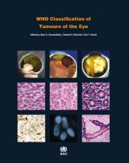 Iarc Publications Website Who Classification Of Tumours