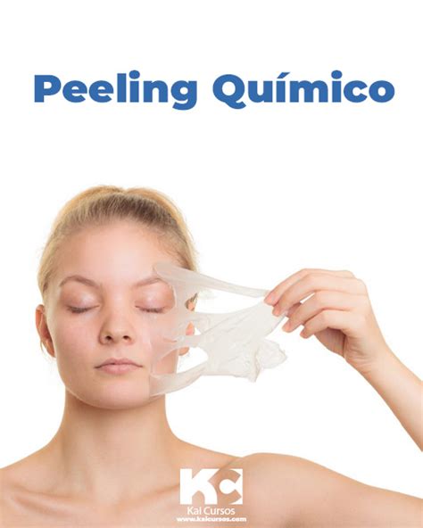 Curso Peeling Qu Mico Cursos Mirandinha