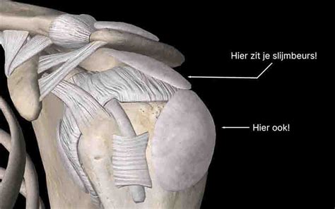 Slijmbeursontsteking Schouder Fysiofabriek
