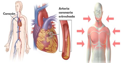 Enfermedades Del Corazón Causas Tipos Tratamiento Y Prevención