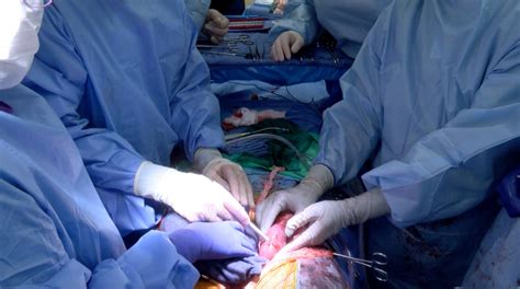 Organ Transplant News SciTechDaily