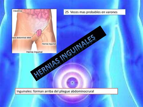 Hernias De La Pared Abdominal Eventracion Y Eviceracion