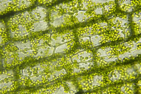 Plant Cells Through A Microscope Micropedia