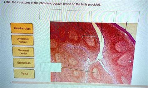 SOLVED Label The Structures In The Photomicrograph Based On The Hints