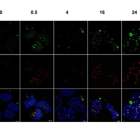 Kinetics Of PML NB Formation In HEK293 Cells In Response To Radiation