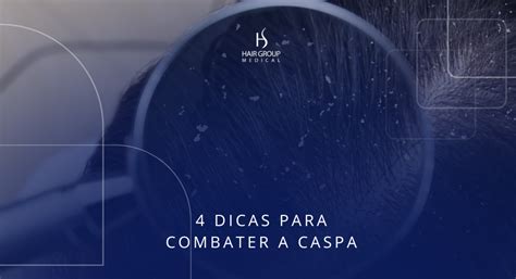 Como Combater A Caspa - 4 dicas para combater a caspa