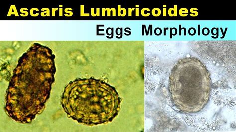 Medical Laboratory Science, Science Student, Morphology