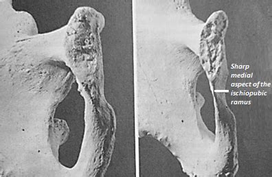 Quick Tips How To Estimate The Biological Sex Of A Human Skeleton