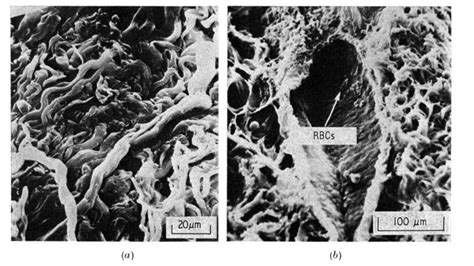 (a) Dermal collagen fibre weave in the skin of a child. The fibres are ...