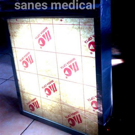 Jual Lampu Baca Foto Rontgen Ssm Ronsen Radiologi Medis Putih Kota