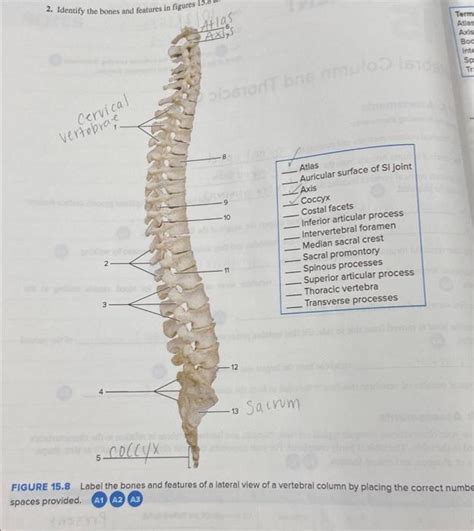 Solved Label Identify The Bones And Features In Chegg