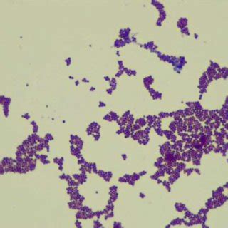 Staphylococcus aureus. Beta hemolysis on blood agar. | Download ...