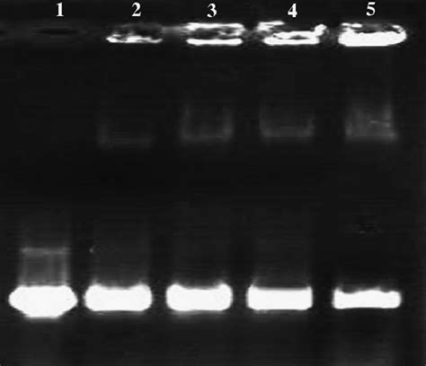 Agarose Gel Electrophoresis Retardation Assay Lane Naked Dna