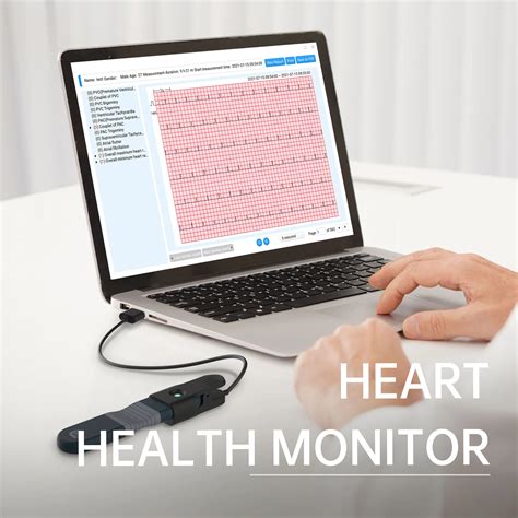 Wellue ER1 24 Hour Wearable EKG ECG Monitor With AI Analysis Real Time