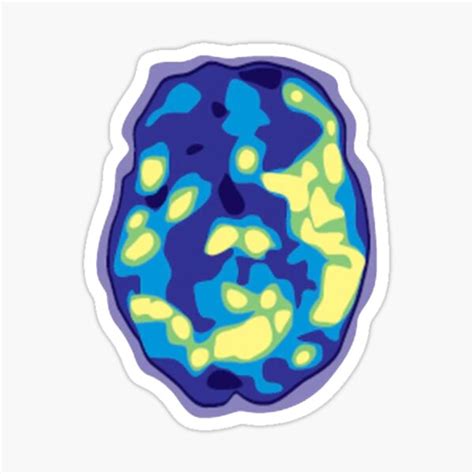 "Bipolar Brain Scan" Sticker for Sale by noahmcg | Redbubble