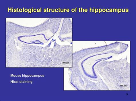 Ppt Pathophysiology Of Learning And Memory Powerpoint Presentation