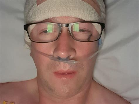 Calderdale Cyclist Was Diagnosed With Two Brain Tumours After