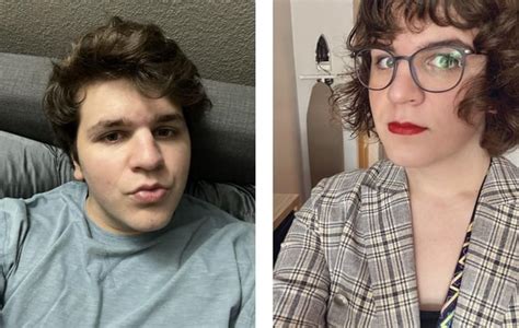 Left Jan ‘22 2 Months Hrt Right Jan ‘23 14 Months R Transtimelines