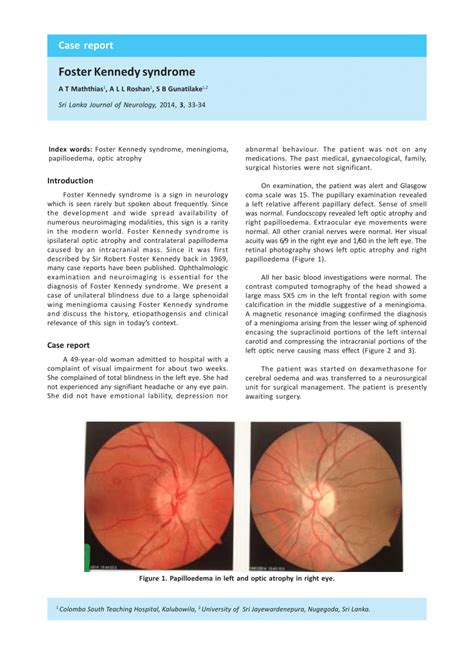 PDF Foster Kennedy Syndrome