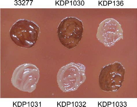 Pigmentation of P. gingivalis strains. P. gingivalis cells were ... 