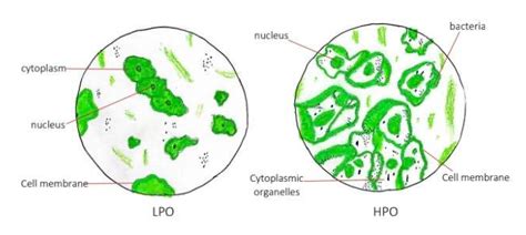 Solved Sample Of Hpo And Lpo Of Microscope Is In The Below Image