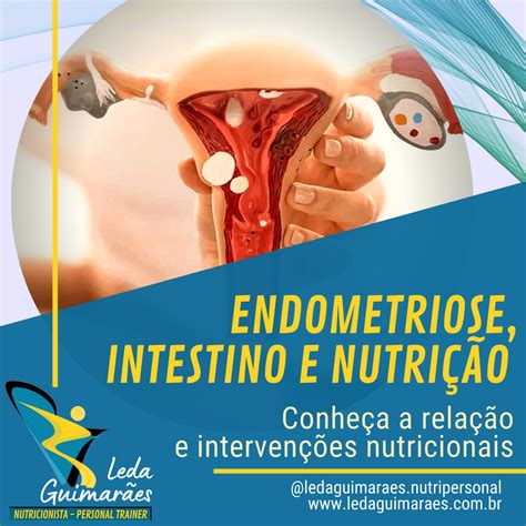 Endometriose Intestino E Nutri O Conhe A A Rela O E Interven Es