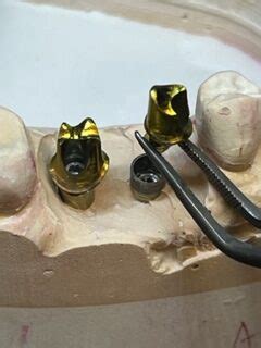 Free Implant Verification Jig Promotion Maestro Dental Studio