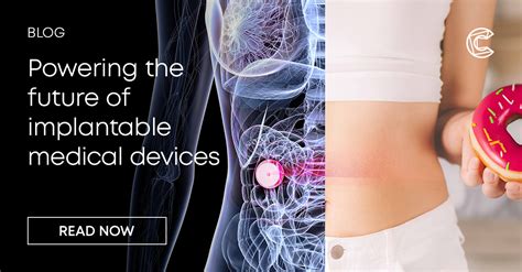 Powering implantable medical devices | Cambridge Consultants