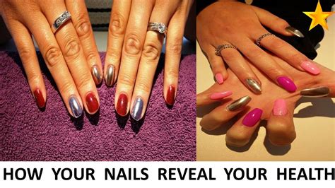 How Your Nails Reveal Your Health Youtube