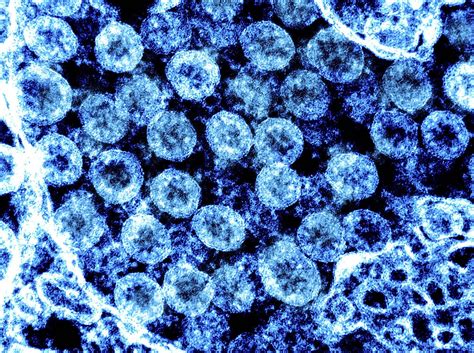 Fotograf As Reales Del Coronavirus Bajo El Microscopio