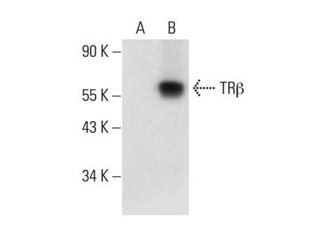 Trβ1抗体 A 7 Scbt Santa Cruz Biotechnology