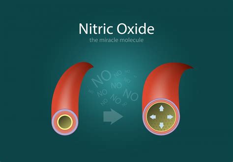 New Form of Mitochondrial Myopathy May Be Treatable with L-arginine ...