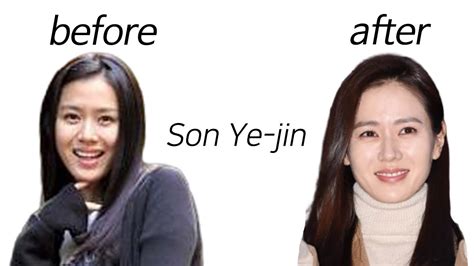 Son Ye Jin Before Surgery Son Ye Jin S Plastic Surgery | The Best Porn ...