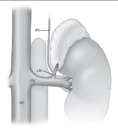 Adrenal Vein Anatomy