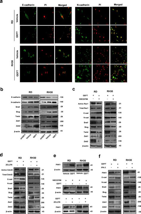 Geft Influences The Expression Of Emt Markers In Rms Cells Via The